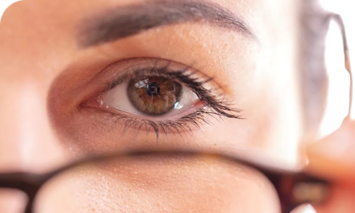 Dry Eyes: causes, symptoms and treatment