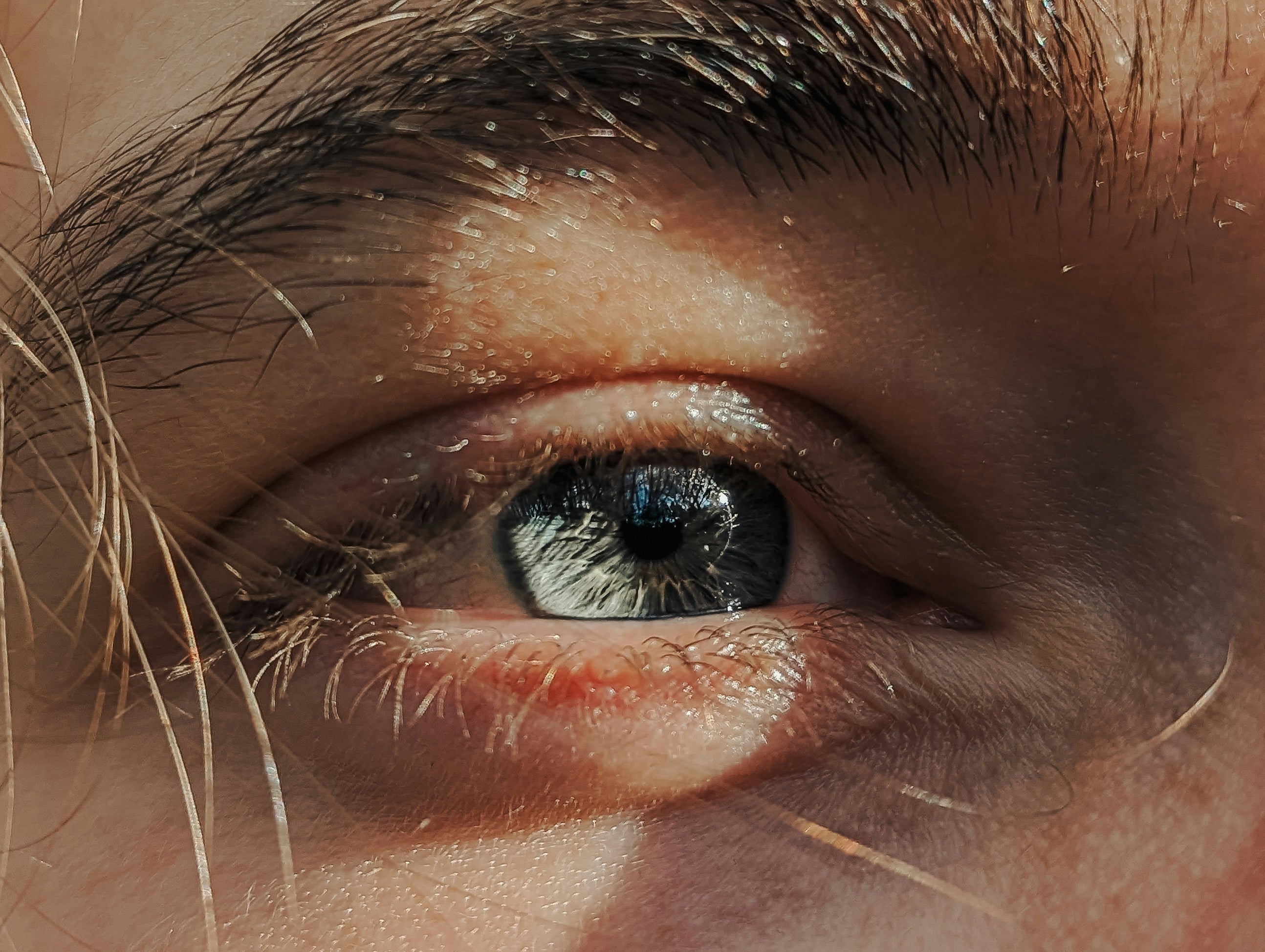 Understanding Astigmatism: Symptoms, Causes, and Solutions
