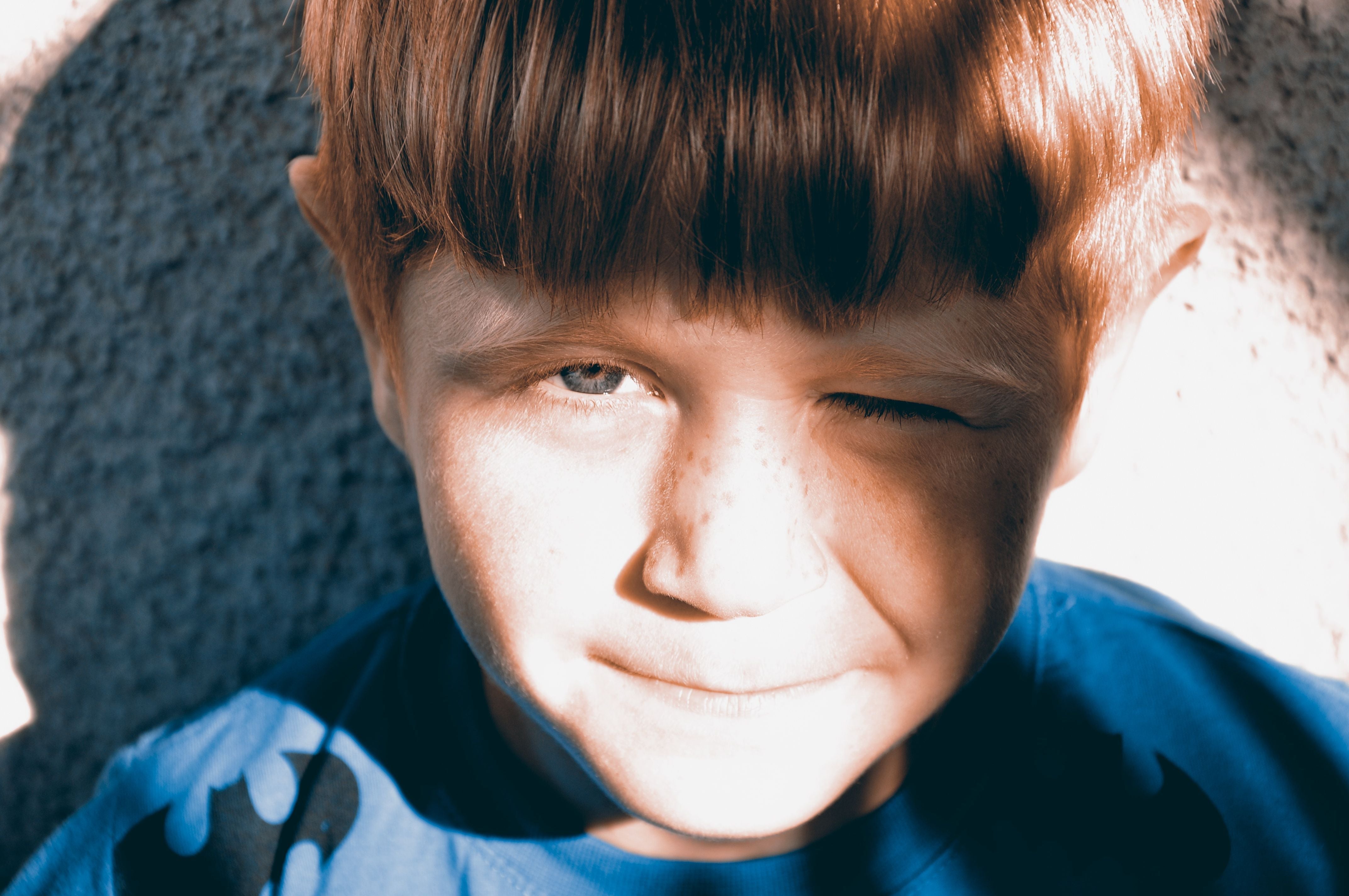 Why Do We Squint in Bright Sunlight?